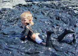 Санаторий им. Пирогова Куяльник Одесса Грязелечение фото